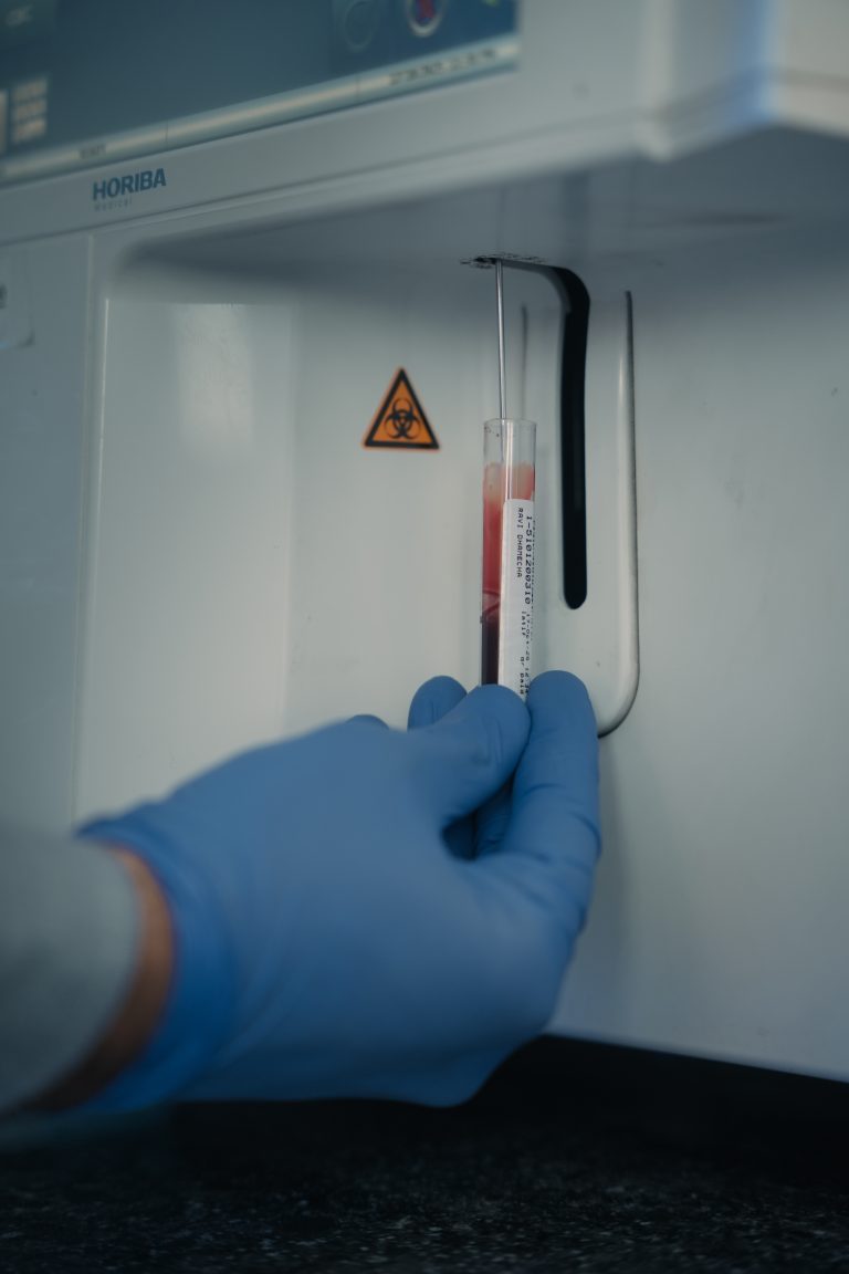 Blood Test Lab in Halol – Wepath Laboratory