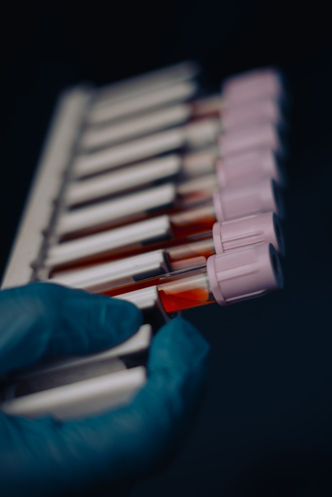 Best Pathology Lab in Bhavnagar – WePath Laboratory
