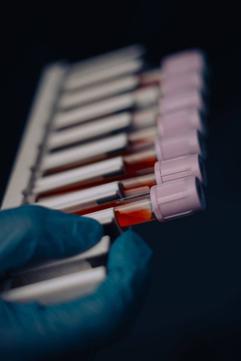 Best Pathology Lab in Bhavnagar – WePath Laboratory